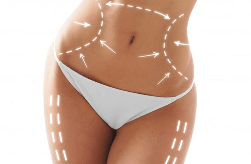 fettsugning plastik fettsugning plastik
